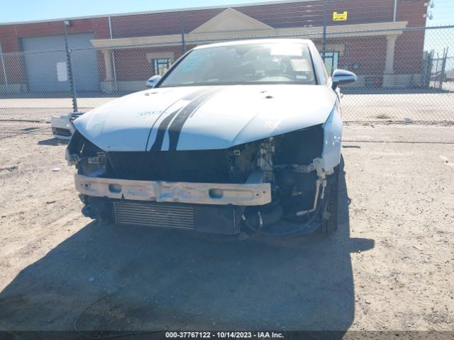 2017 AUDI A4 WAULNAF40HA147288 Photo 5