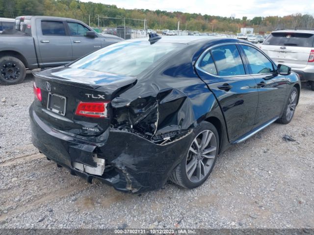 19UUB3F81KA005359 Acura Tlx W/advance Pkg