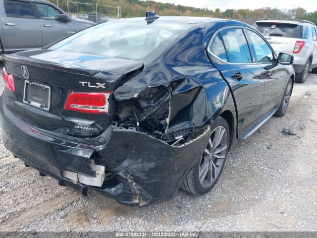 19UUB3F81KA005359 Acura Tlx W/advance Pkg