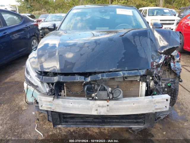 1N4BL4EV2KC155572 Nissan Altima 2.5 Sl