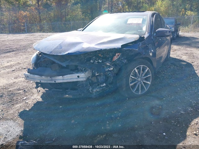 19UUB1F56JA010047 Acura Tlx Tech Pkg