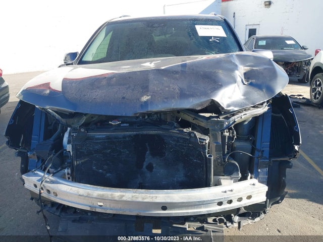 Acura Mdx W/advance Package 2017 5FRYD4H8XHB022351 Image 13