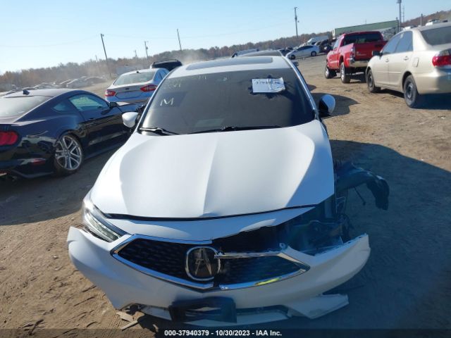 19UDE2F7XLA003104 Acura Ilx Technology Package/premium Package