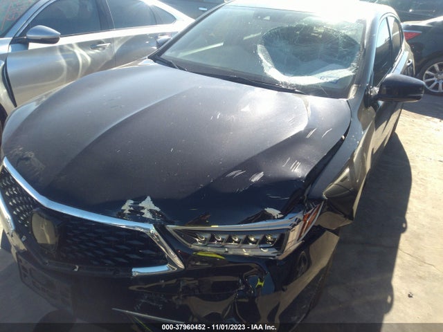 19UUB1F54JA007941 Acura Tlx Tech Pkg
