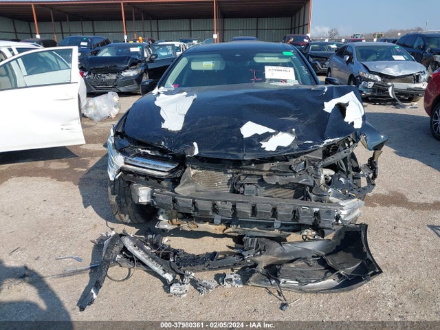 Acura Tlx Technology Package 2021 19UUB5F48MA010229 Image 13