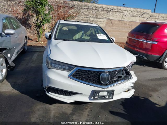 19UUB1F33JA006522 Acura TLX