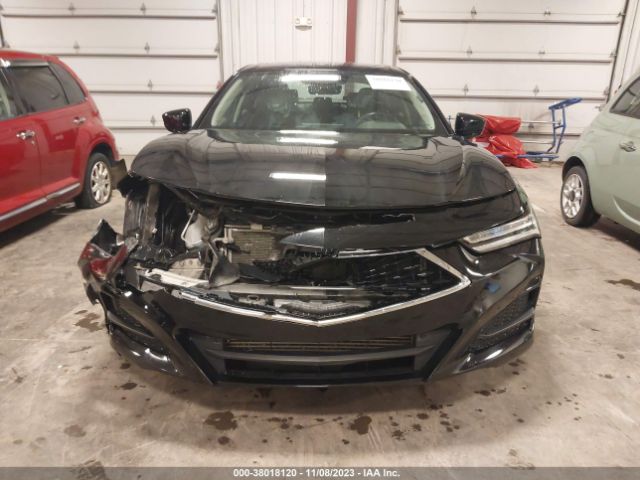 19UUB5F47MA009928 Acura Tlx Technology Package