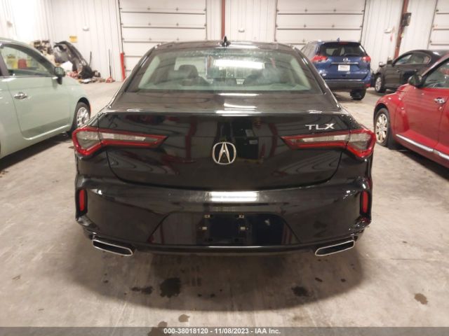 19UUB5F47MA009928 Acura Tlx Technology Package