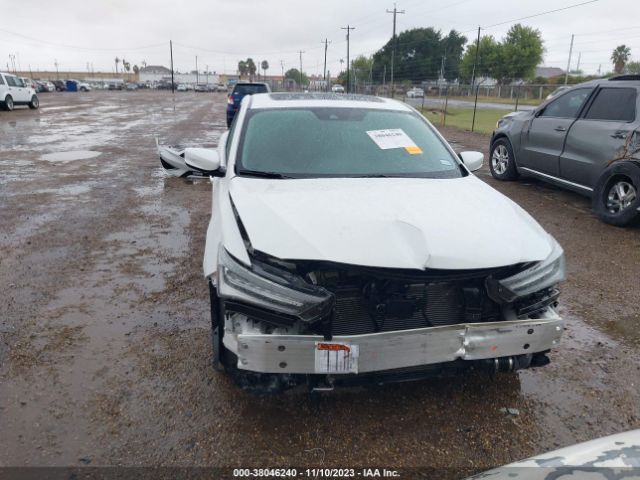 19UDE2F75MA002315 Acura Ilx Technology Package/premium Package