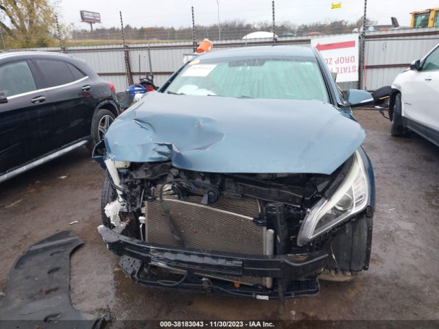 5NPE34AF5HH441404 Hyundai Sonata Sport