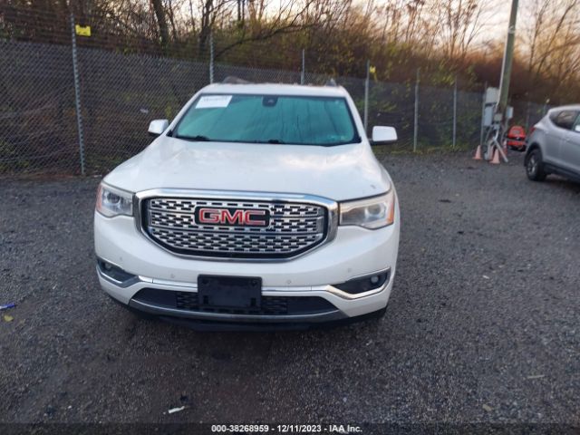 1GKKNXLS2HZ172073 GMC Acadia Denali