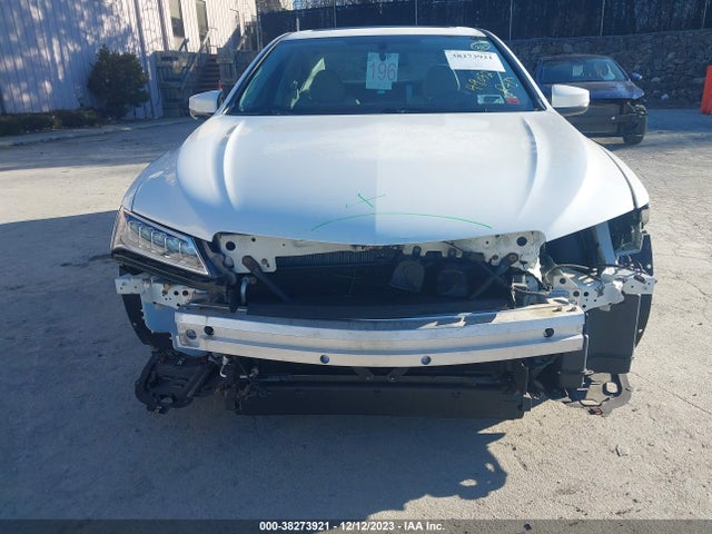 Acura TLX 2015 19UUB1F31FA008163 Image 6