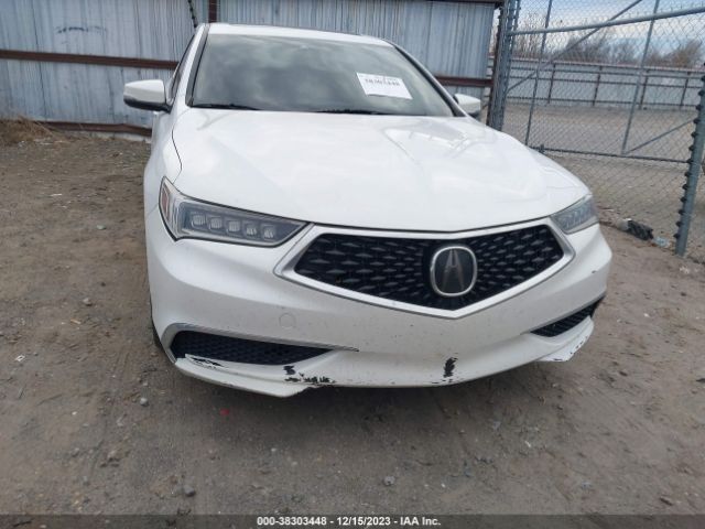 19UUB3F33KA004847 Acura Tlx Standard