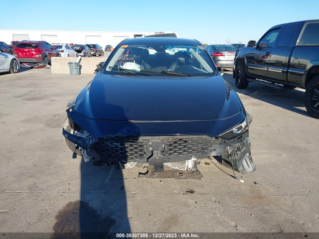 JM1BPABL2M1315822 Mazda Mazda3 Select