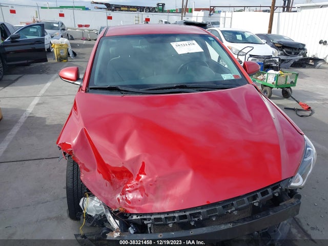 Hyundai ELANTRA SE 2017 5NPD74LF9HH066386 Image 13