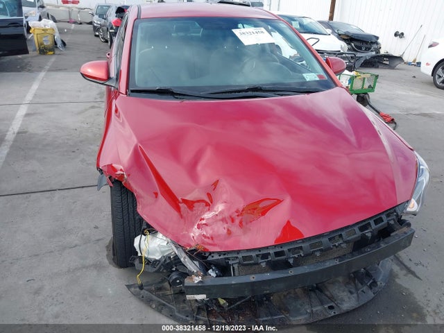 Hyundai ELANTRA SE 2017 5NPD74LF9HH066386 Image 6