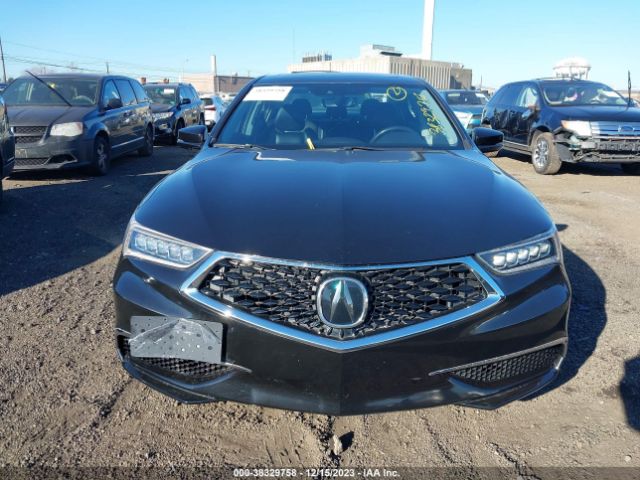 19UUB1F35KA002604 Acura Tlx Standard