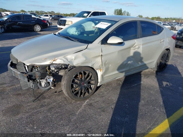 Hyundai ELANTRA SE 2017 KMHD74LF9HU395526 Image 2