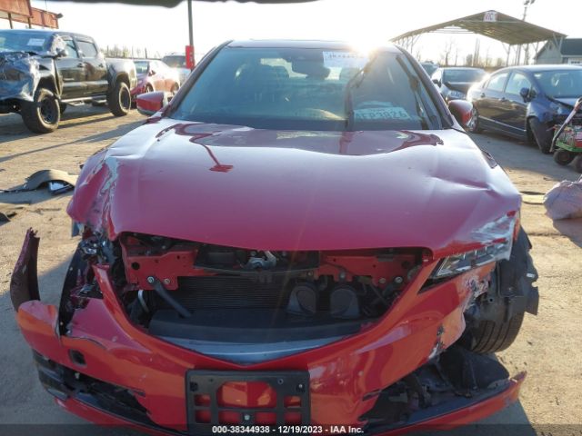 19UUB1F56HA000645 Acura Tlx Technology Package