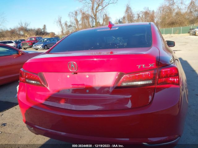 19UUB1F56HA000645 Acura Tlx Technology Package