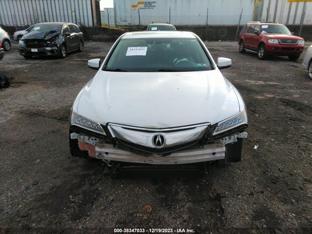 Acura Tlx Technology Package 2017 19UUB1F54HA004130 Image 6