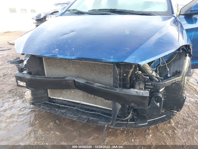 Hyundai ELANTRA SE 2018 5NPD74LF3JH277010 Image 6