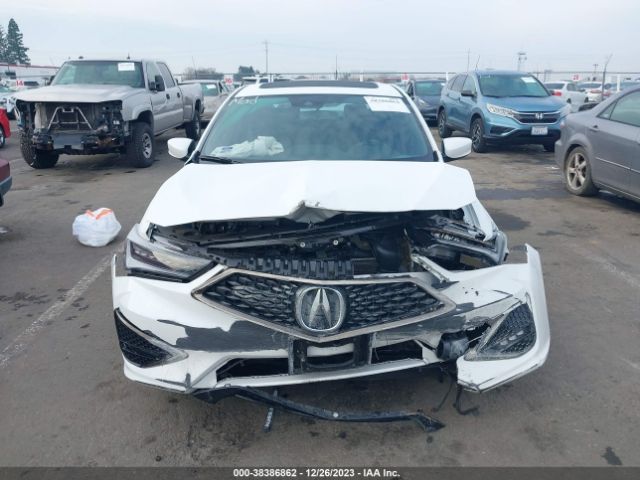 19UDE2F87NA005131 Acura Ilx Premium   A-spec Packages/technology   A-spec Packages
