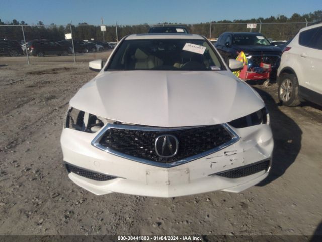 19UUB1F58LA005662 Acura Tlx Tech Package