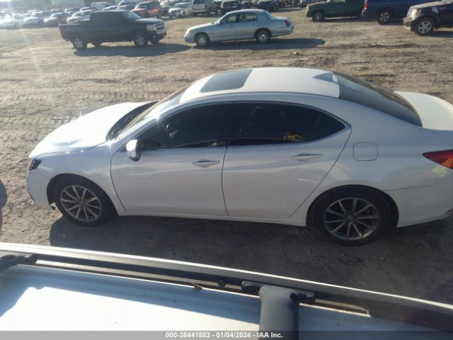 19UUB1F58LA005662 Acura Tlx Tech Package