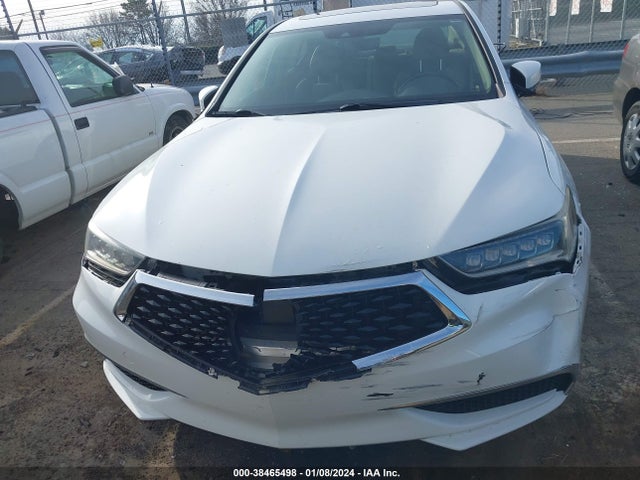 Acura TLX 2018 19UUB1F31JA002484 Image 12