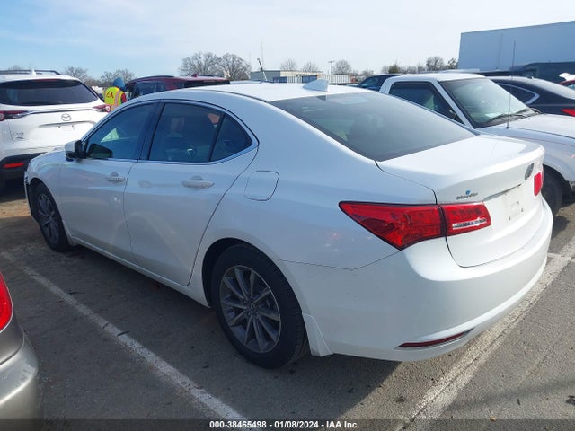 Acura TLX 2018 19UUB1F31JA002484 Image 3