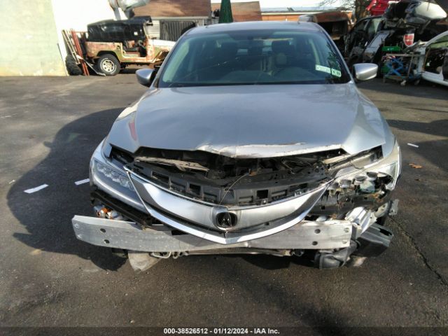 19UDE2F31JA005284 Acura Ilx Acurawatch Plus Package