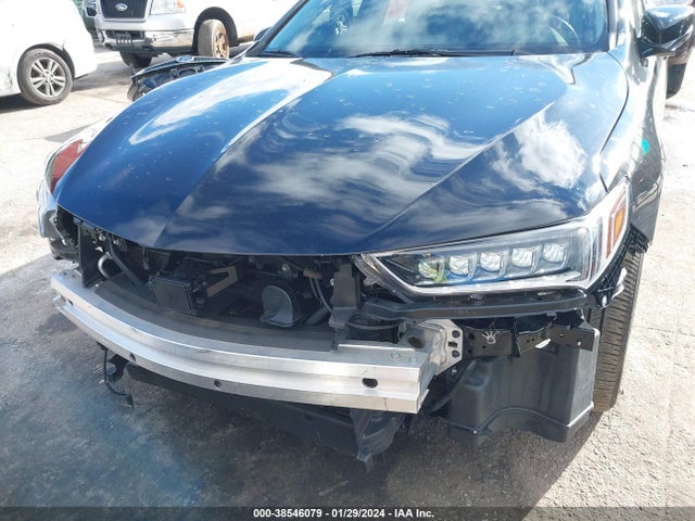 19UUB1F55JA005115 Acura Tlx Tech Pkg
