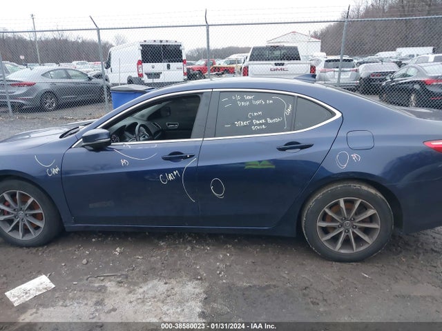 Acura TLX 2018 19UUB1F30JA008020 Image 15