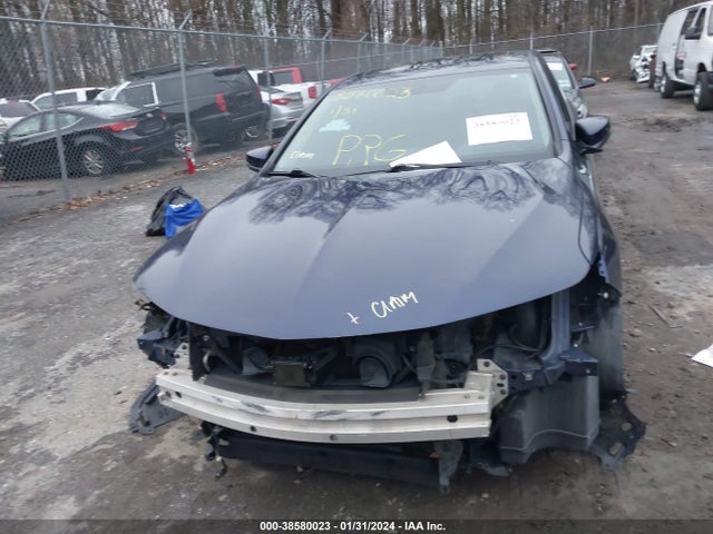 19UUB1F30JA008020 Acura TLX