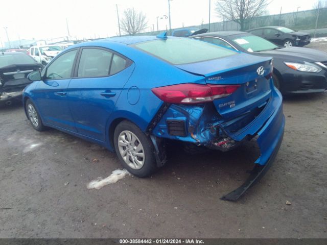 KMHD74LF4HU362157 Hyundai ELANTRA SE