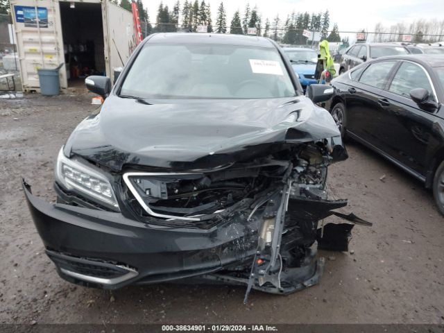 5J8TB4H53HL004263 Acura Rdx Technology Pkg/w/technology/acurawatch Plus Pkg