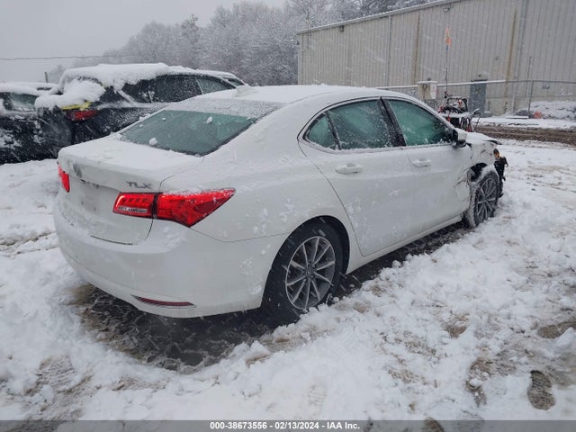 Acura TLX 2018 19UUB1F37JA000643 Image 4