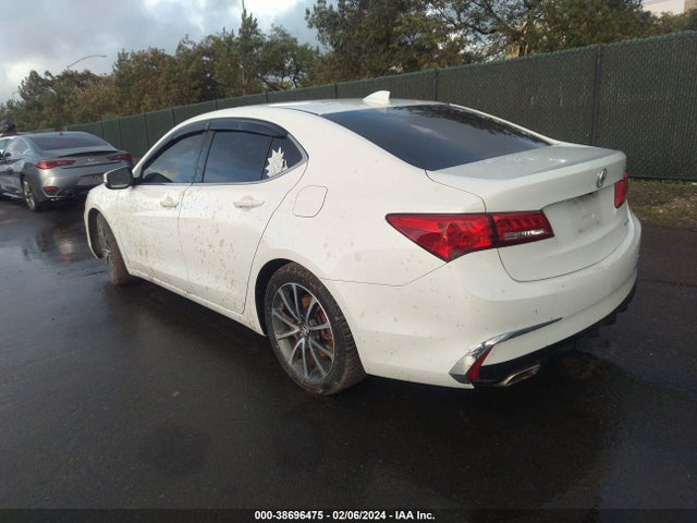 Acura TLX 2018 19UUB3F34JA002328 Image 3