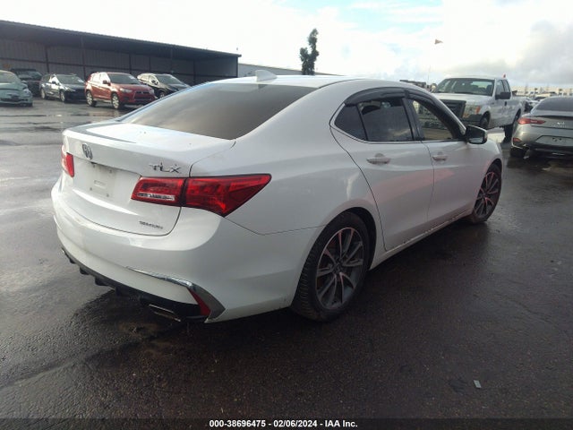 Acura TLX 2018 19UUB3F34JA002328 Image 4