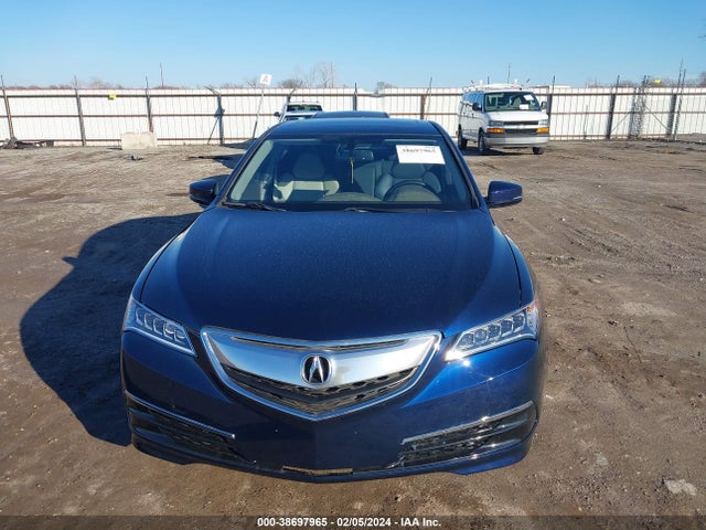 Acura TLX 2017 19UUB1F30HA009792 Image 12