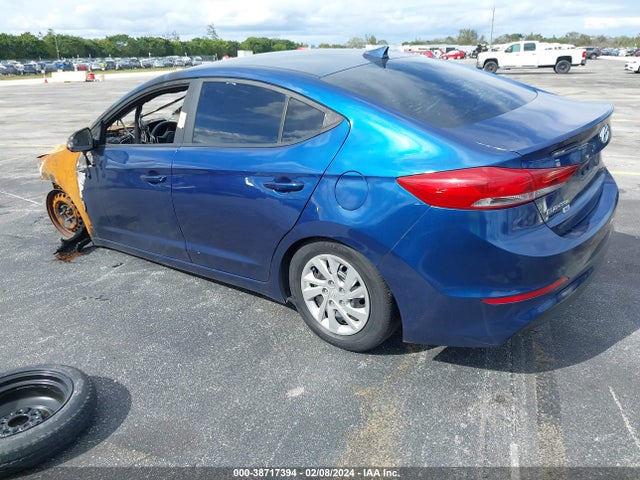 Hyundai ELANTRA SE 2017 5NPD74LF3HH183428 Image 3