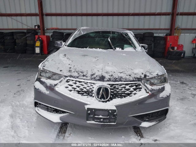 Acura TLX 2018 19UUB2F30JA005513 Image 12