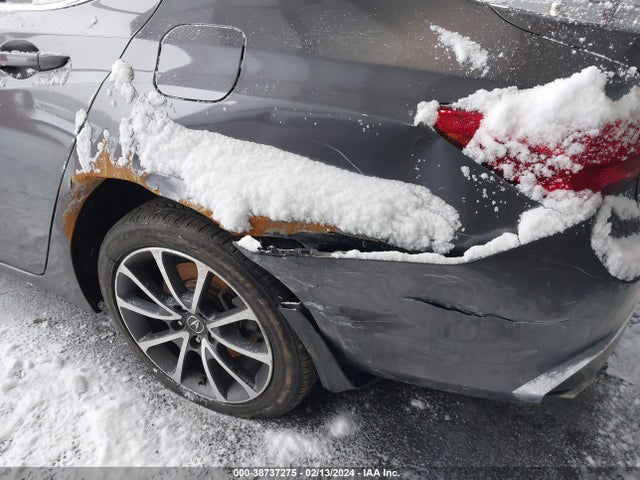 Acura TLX 2018 19UUB2F30JA005513 Image 6