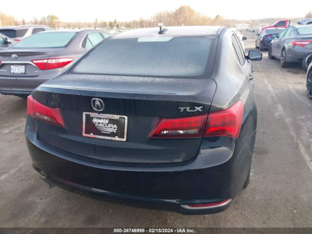 19UUB1F59HA005077 Acura Tlx Technology Package