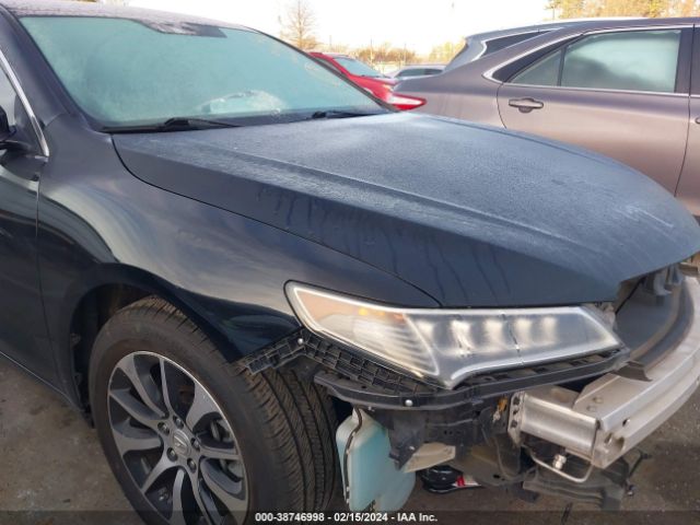 19UUB1F59HA005077 Acura Tlx Technology Package
