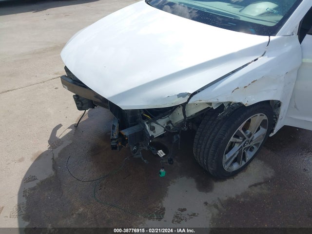 Hyundai Elantra Limited 2017 5NPD84LF6HH056668 Image 6