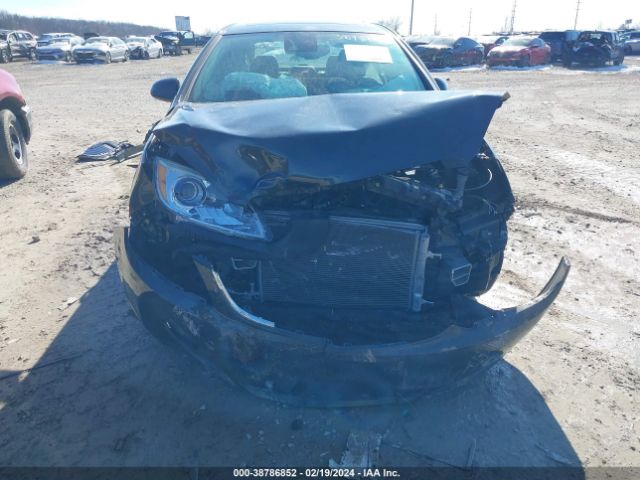 1G4PR5SK7E4161554 Buick Verano Convenience Group