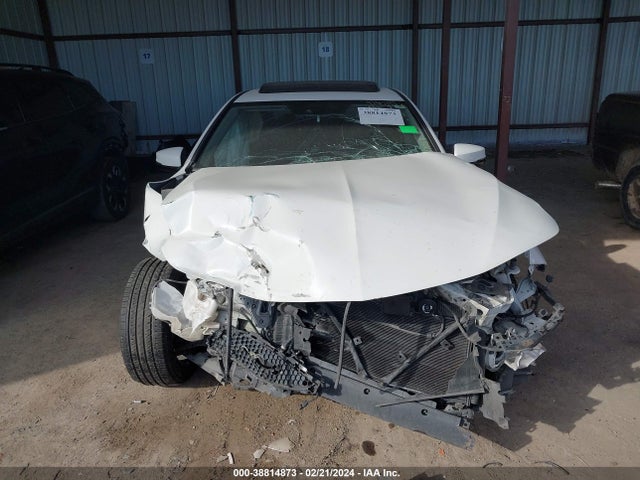 Acura TLX 2018 19UUB1F3XJA007053 Image 11