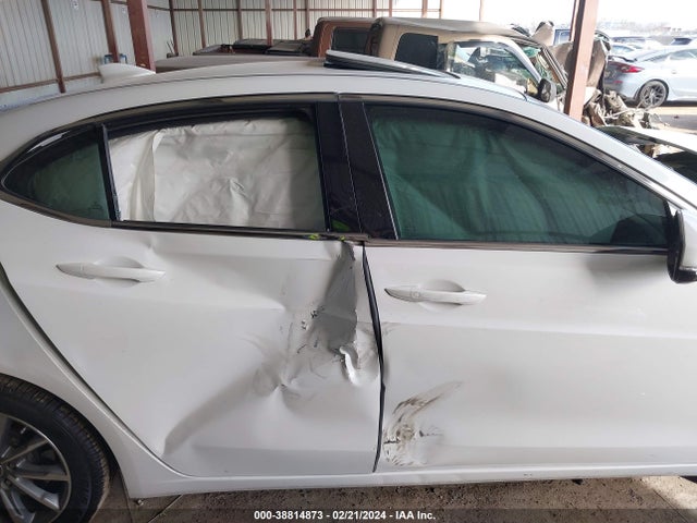 Acura TLX 2018 19UUB1F3XJA007053 Image 12